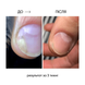 Сыворотка при повреждении ногтевой пластины и онихолизисе GreenHealth 10 мл (VIS-004742)
