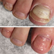 Сыворотка при повреждении ногтевой пластины и онихолизисе GreenHealth 30мл (VIS-004743)